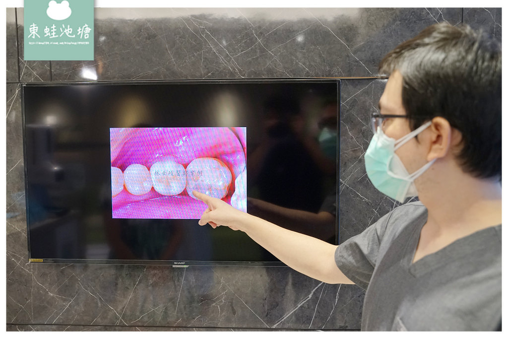【台北人工植牙專科推薦】美國波士頓大學牙周病專科 林士峻醫師 細心詳細牙周病檢查過程 優政牙醫診所 【台北人工植牙專科推薦】美國波士頓大學牙周病專科 林士峻醫師 細心詳細牙周病檢查過程 優政牙醫診所