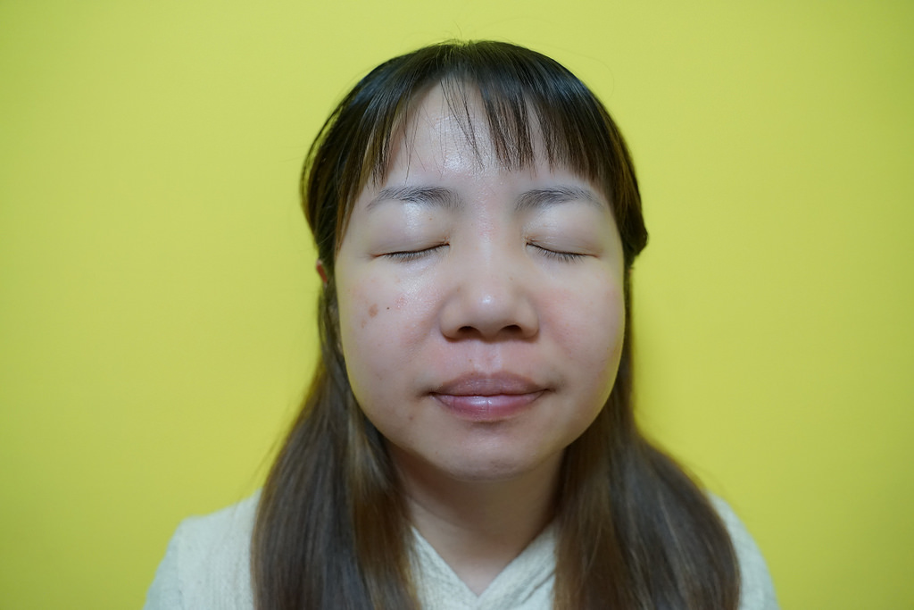 【新竹醫美推薦】PicoWay超皮秒蜂巢雷射 網友超推薦 微依美精品醫美診所 【新竹醫美推薦】PicoWay超皮秒蜂巢雷射 網友超推薦 微依美精品醫美診所